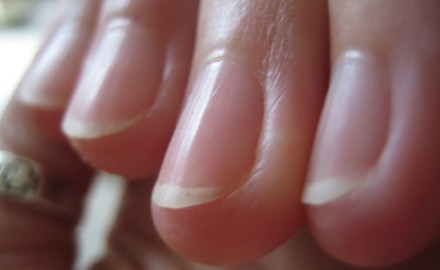 por qué tenemos uñas